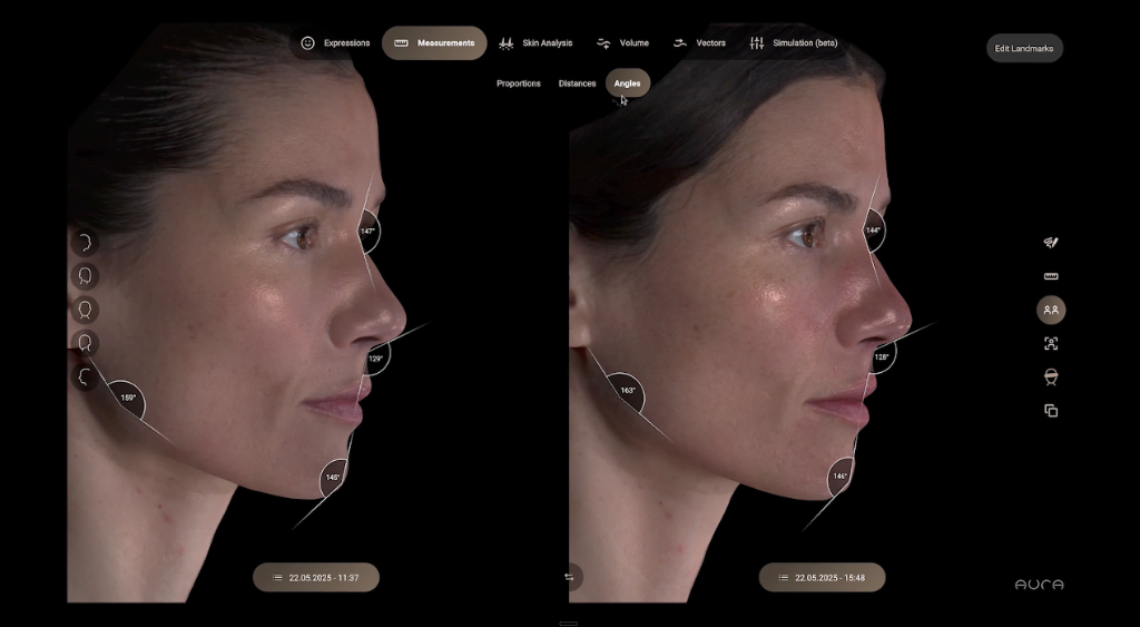 Aura 3D Compare Mode Screen